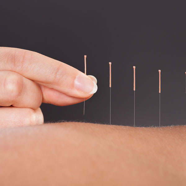 Marlton Chiropractor Chiropractic Marlton New Jersey Chiropractors NJ 08053